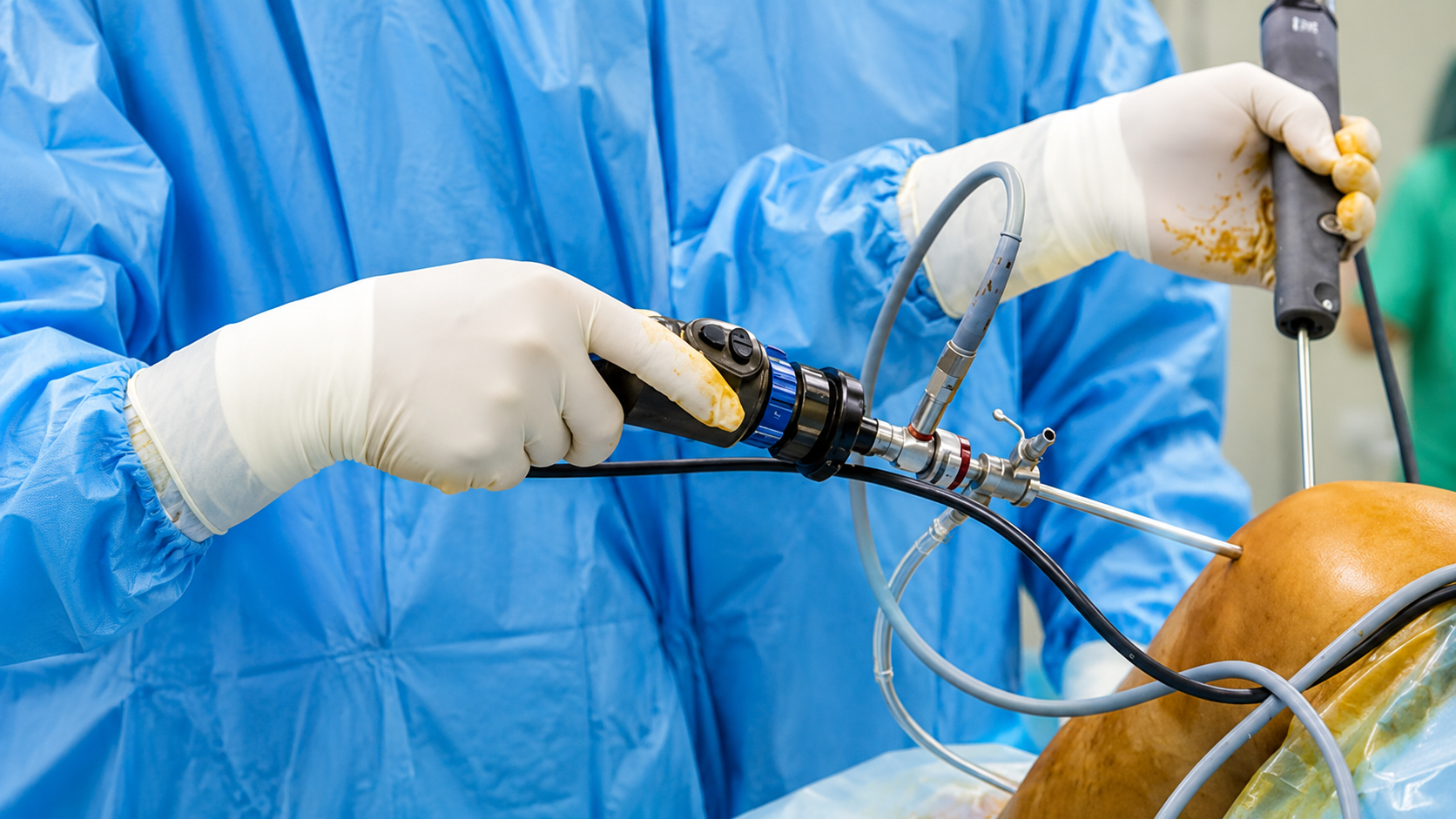 Arthroscopic Shoulder Surgery at Dr. Vinoth's Advanced Ortho Clinic